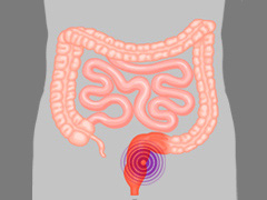 無(wú)精的癥狀主要有哪些？